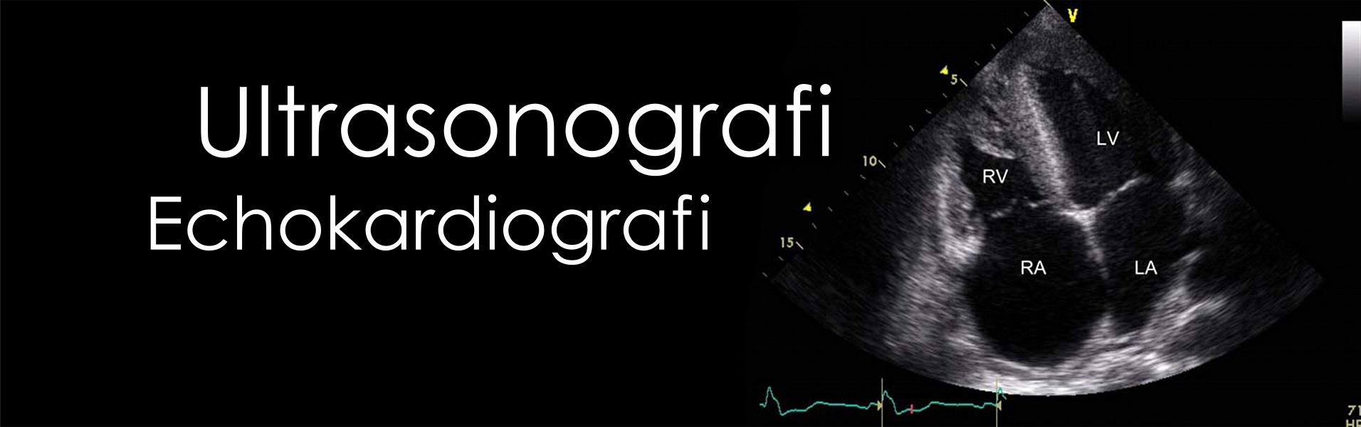 Ultrasonografi ve Ekokardiyografi